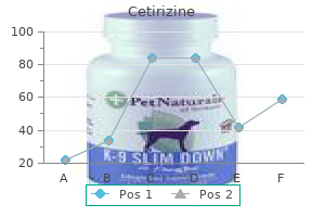buy cetirizine 10 mg mastercard